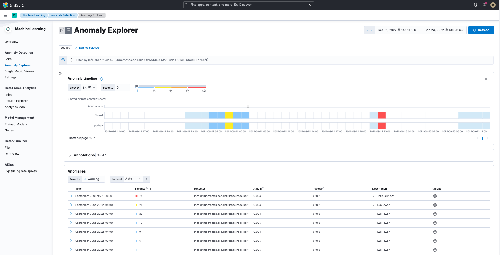 Erkennen von Anomalien in Logdaten in Elastic Observability